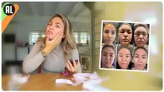 ZWARE ALLERGISCHE REACTIE (levensgevaarlijk) // Tjits Vlog #887