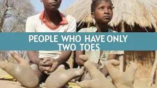 Vadoma People With Only Two Toes | Yakkie Ufodiama