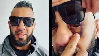 المصارع الجزائري سعيد معلم يكشف سبب خسارته أمام اللبناني خليفة ويفضح الحكم