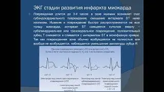 Степанец Е.А. Острый коронарный синдром. Инфаркт миокарда