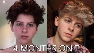 4 MONTHS ON T- FTM TRANSGENDER  | NOAHFINNCE