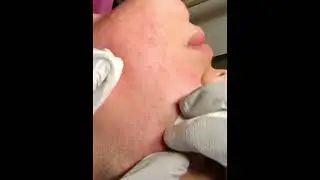 Extractions 3 clients