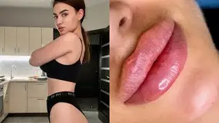 Я ОКОНЧАТЕЛЬНО ВЕРНУЛАСЬ ! похудела на 10 кг, увеличила губы