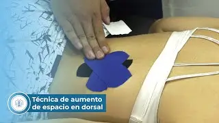 Técnica de aumento de espacio en dorsal