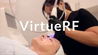 VirtueRF Facial Rejuvenation at Honolulu MedSpa