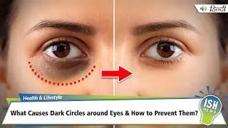 What Causes Dark Circles around Eyes & How to Prevent Them? | ISH News