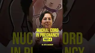 Nuchal cord in pregnancy explained 