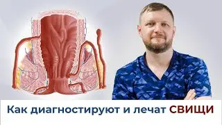 СВИЩИ ПРЯМОЙ КИШКИ: диагностика и лечение