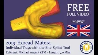 FREE FULL EXOCAD TUTORIAL - Exocad-Matera Individual Trays with the Bite-Splint-Tool