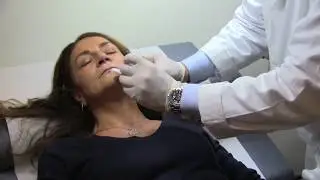 Face rejuvenation with HYAcorp fillers