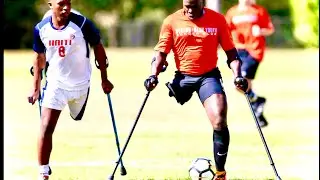 INSPIRING_STORY OF EDWIN ,ABOVE KNEE AMPUTEE FROM 