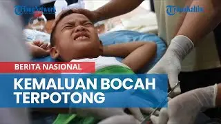 Kemaluan Bocah Terpotong Saat Sunatan Massal di Riau