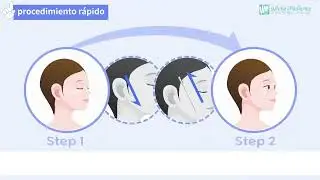 Coig LA explicación  grafica de las características del hilo tensor
