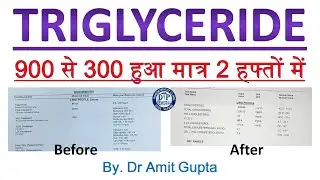 Hyperlipidemia control by homoeopathy (#कोलेस्ट्रॉल नियंत्रण मात्र 2 हफ्तों में)