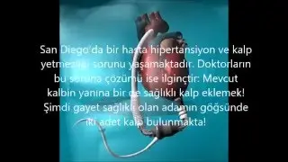 Duyduğunuza İnanamayacağınız Tıp Vakaları