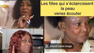 Les filles qui se dépigmentent la peau venez écouter