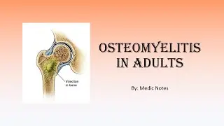 Osteomyelitis in adults - causes, symptoms, classification, investigations, treatment, complications