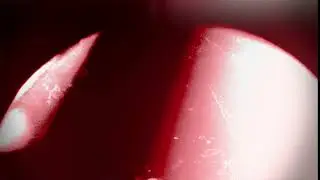 Professional Light Leaks Film Burn Overlay | Grunge Transitions , texture free Full HD