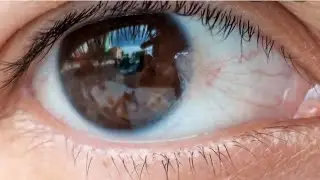 Surfers Eye 👁