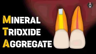 Mineral Trioxide Aggregate | MTA in Endodontics