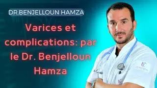 Varices et complications: par le Dr. Benjelloun Hamza
