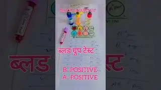 blood group test #bloodgroup #group| A positive | B positive | #shorts #youtubeshorts