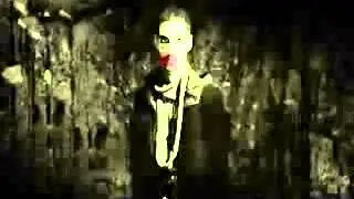 EL JoKeR +18 الجوكر قرصة ودن