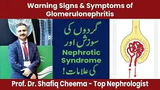 Warning Signs & Symptoms of Glomerulonephritis & Nephrotic Syndrome 