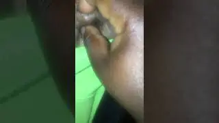 Satisfying Sunday #3 rising underarm bump