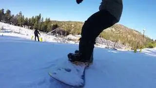 IGclip