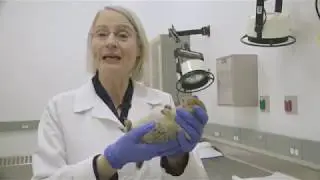 Human Hibernation Medical Breakthrough