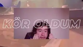 BoneIntro5