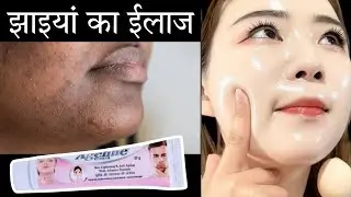 Doctor's No-1 Fairness Cream Best and Affordable Skin Whitening Cream | Skin Peeling 2025