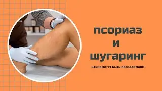 Можно ли при лечении псориза делать шугаринг?