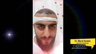 Adana Saç Ekimi | Dr. Murat Keskin