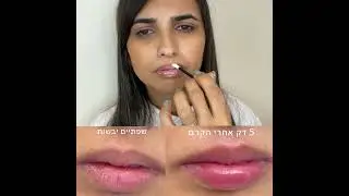 שפתיים רכות, לחות, בשרניות ומטופלות - גם בימים הכי קרים ויבשים של החורף.אוהבת את שיטת הטיפול שלי