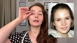 Нависшее веко - генетика или неправильная работа мышц