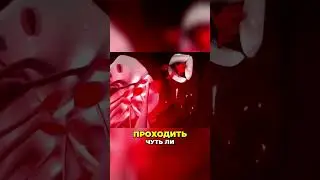Станислав Лосев раскрывает методы борьбы с инсультом