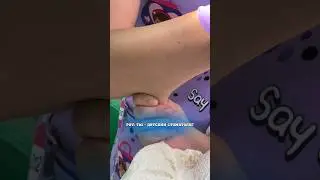 POV: ты детский стоматолог 😂🤪😱 #shorts