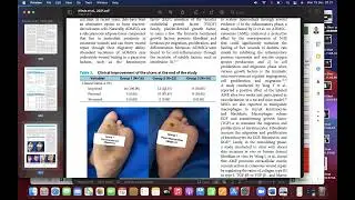 Cara Analisis Data Systematic Review untuk Publikasi Jurnal Internasional Bereputasi