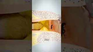 Why you should check your ears.