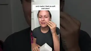 Removing blackheads has never been so satisfying #smartbud #blackheadremovals #SpaDay #SkinTreatment