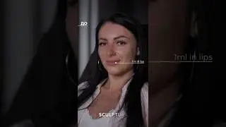 Наши работы - это индивидуальный подход и естественное омоложение #увеличениегуб
