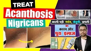 गर्दन का कालापन कारण और इलाज | Dark Neck Treatment | Gardan ka kalapan | Kumar’s Ayurvedic gyan