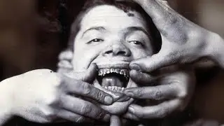 Top 10 Haunting Tales From Abandoned Psychiatric Hospitals