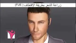 زراعة الشعر بطريقة الاقتطاف ( FUE)
