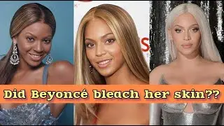 Beyoncé faces heavy BLEACHING accusations