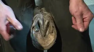 Foot Evaluation in Ohio