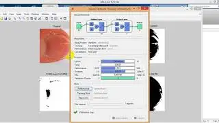 Enhanced Fingernail Recognition based on GLCM, SIFT and neural network