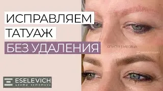 КАК ПЕРЕКРЫТЬ СТАРЫЙ ТАТУАЖ? В КАКИХ СЛУЧАЯХ МОЖНО ПЕРЕКРЫТЬ ТАТУАЖ?